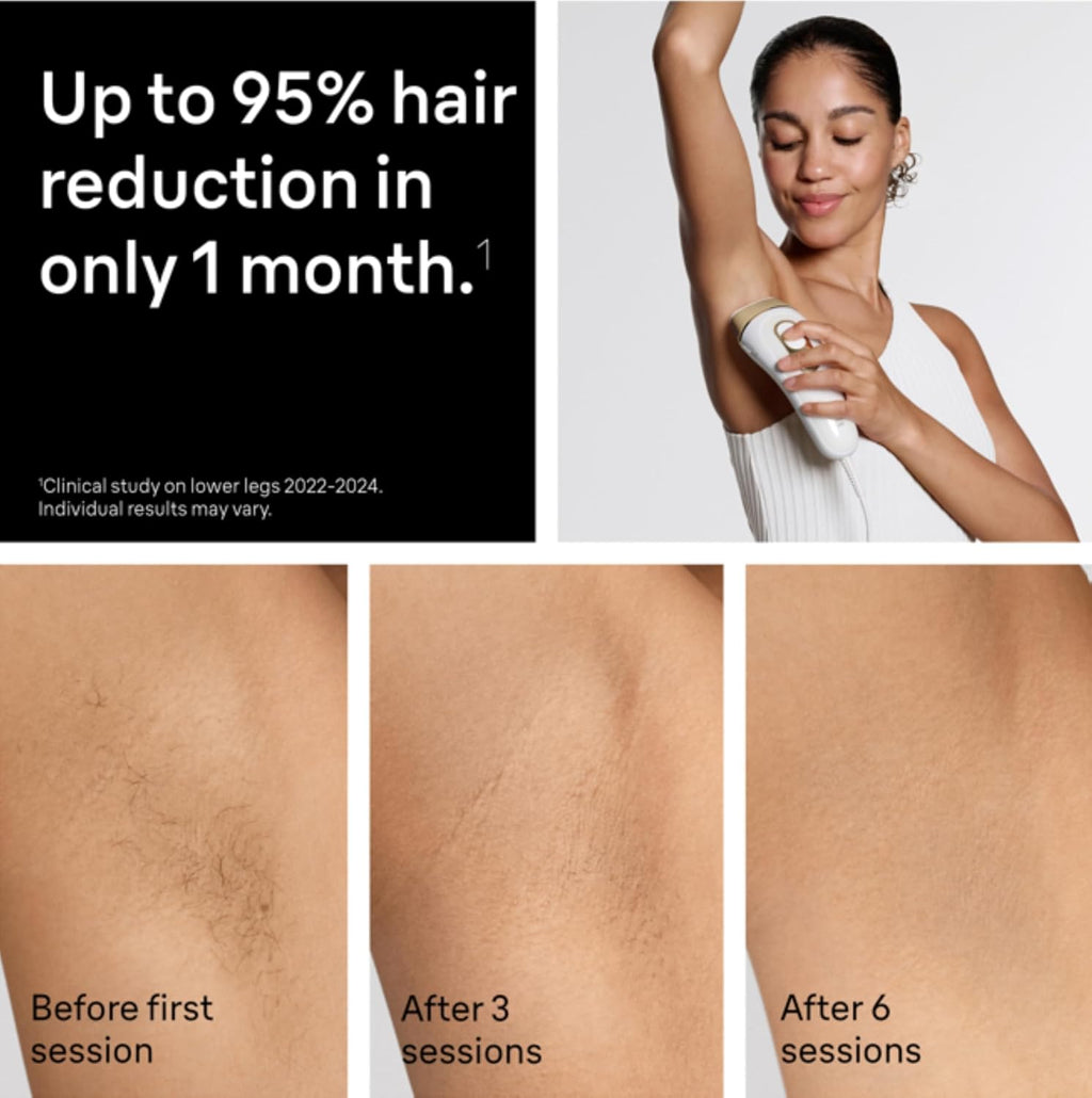 IPL Hair Removal Device – At-Home Permanent Hair Reduction