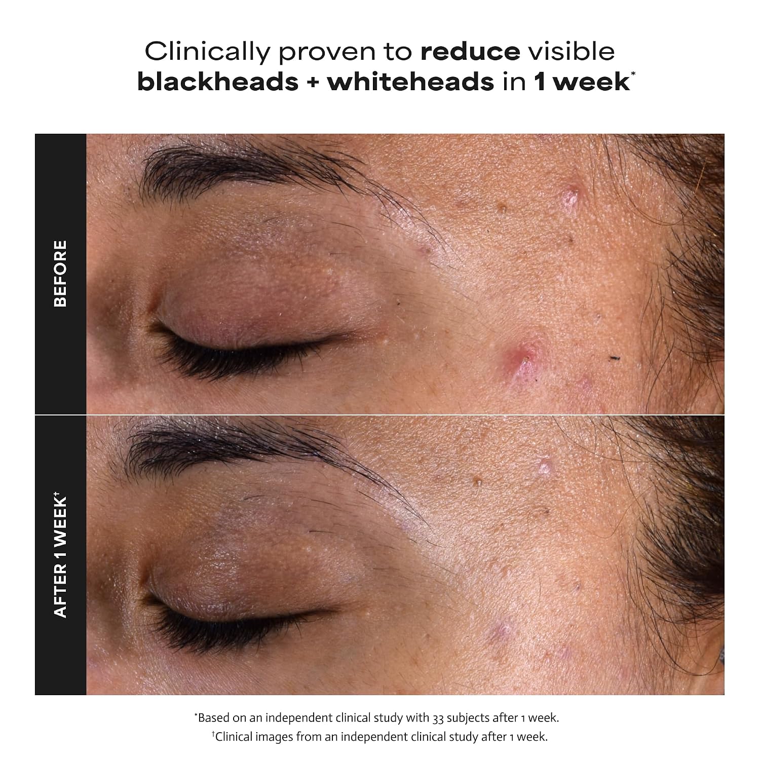 2% BHA Liquid Exfoliant For Smooth, Clear-Looking Skin