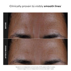 2% BHA Liquid Exfoliant For Smooth, Clear-Looking Skin