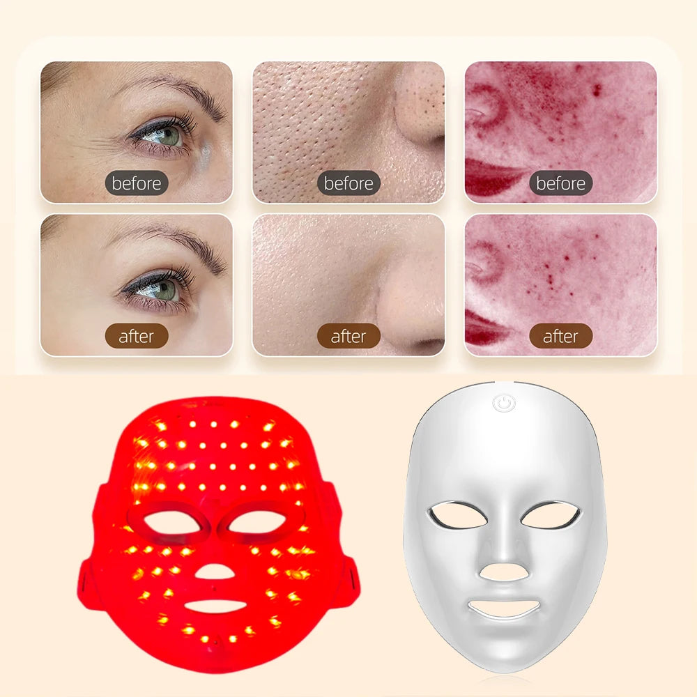 Rechargeable 7 Color LED Facial Mask – Full Face Care