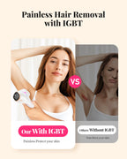 IPL Laser Hair Removal Device – Fast, Nearly Painless